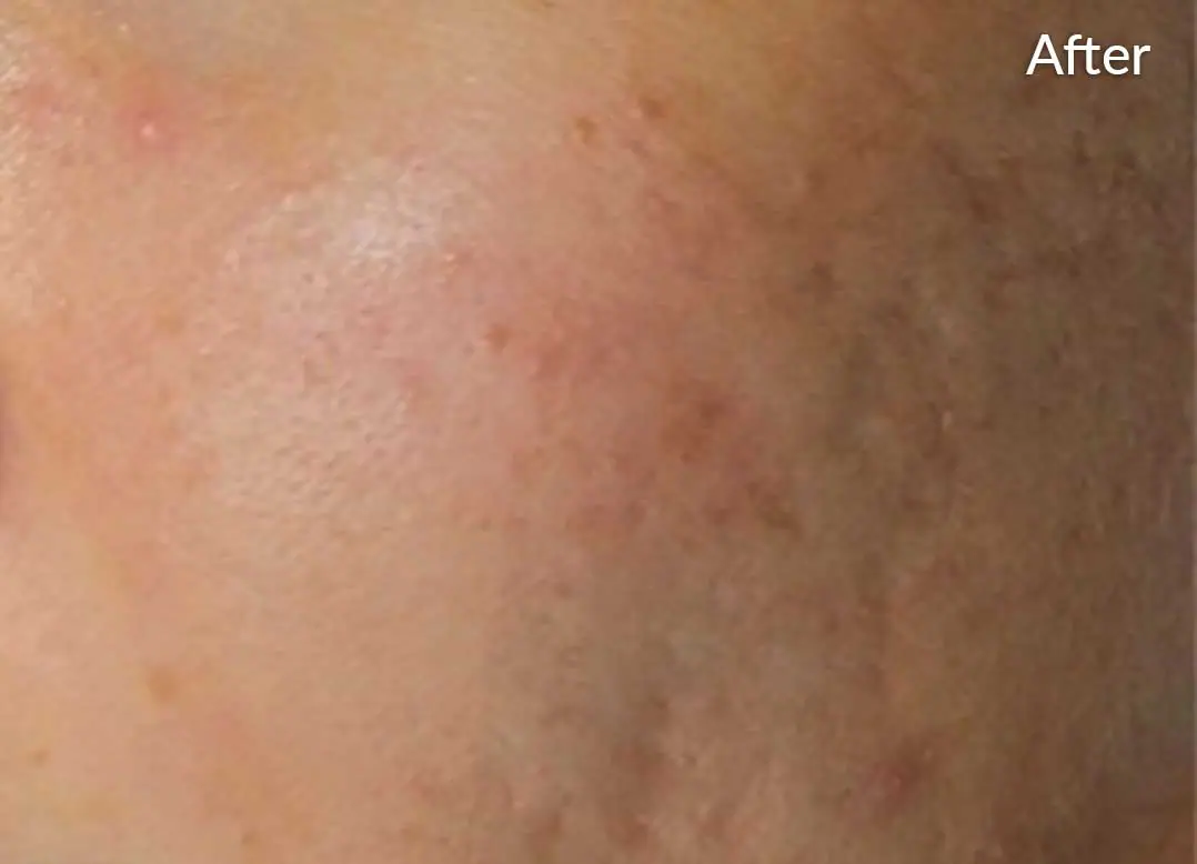 Before image